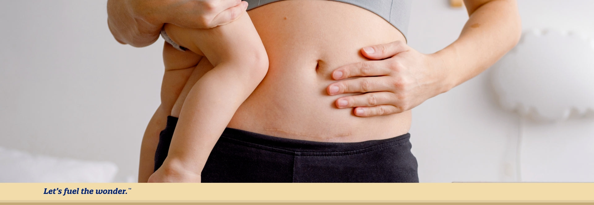 Parent standing up with visible C-section scar below belly button with left hand on belly while holding baby that is out of frame in parent's right arm.